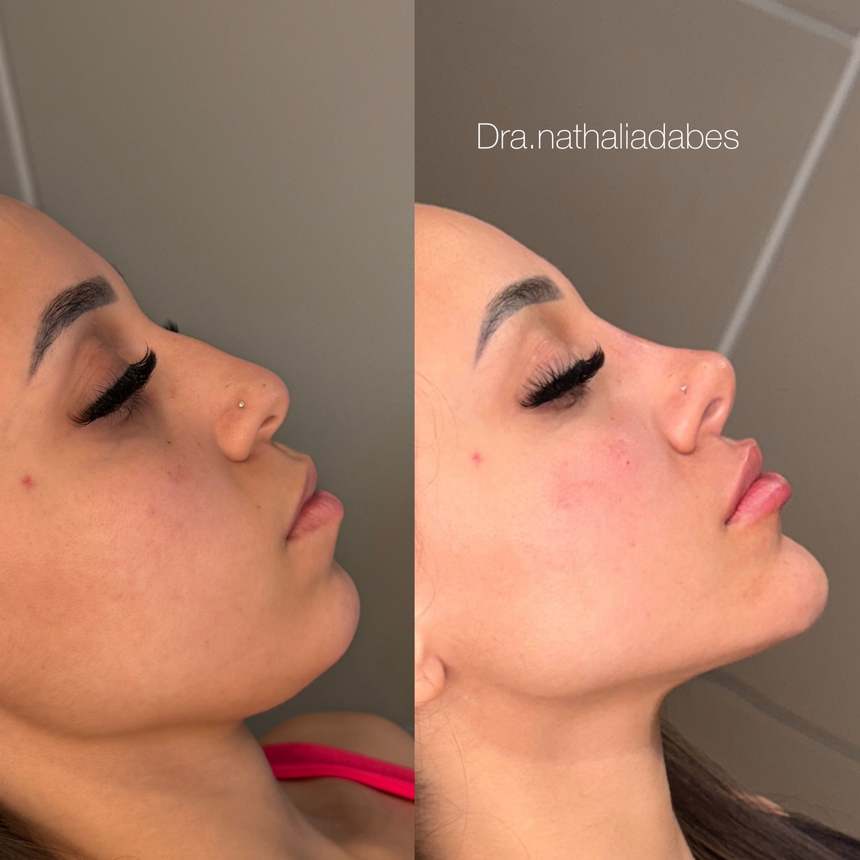 Antes do tratamento — caso 1