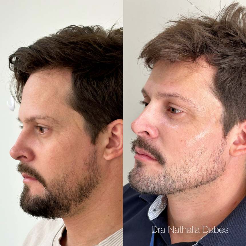 Antes do tratamento — caso 3