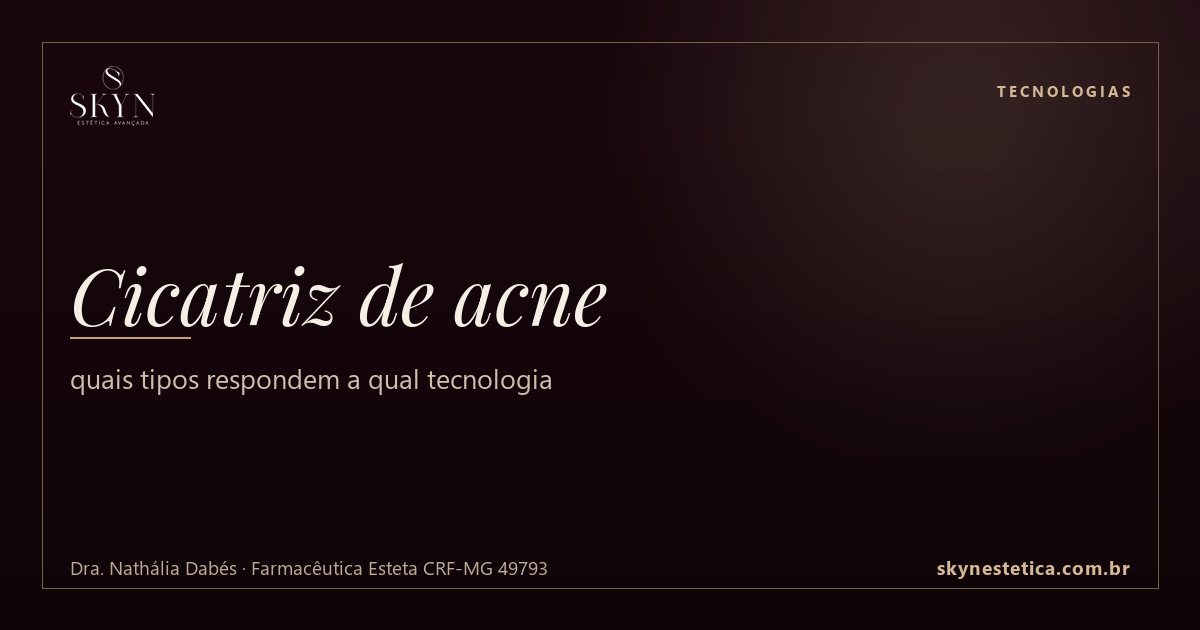Cicatriz de acne: quais tipos respondem a qual tecnologia