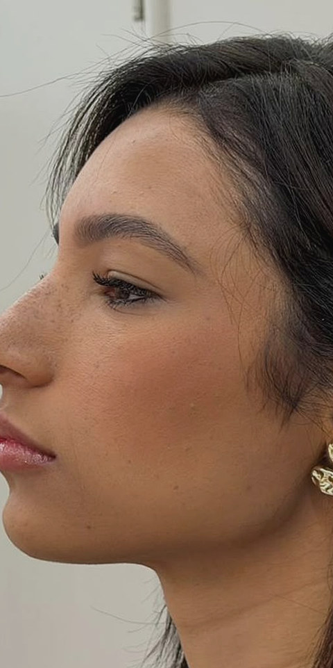 O mesmo paciente, mesma sessao fotografica, depois do procedimento.